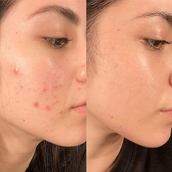 Pore and facial cleanser - Luminous